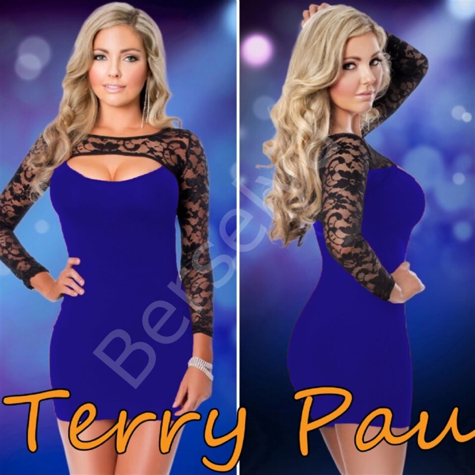 B101169 Dantel Detaylı Elbise