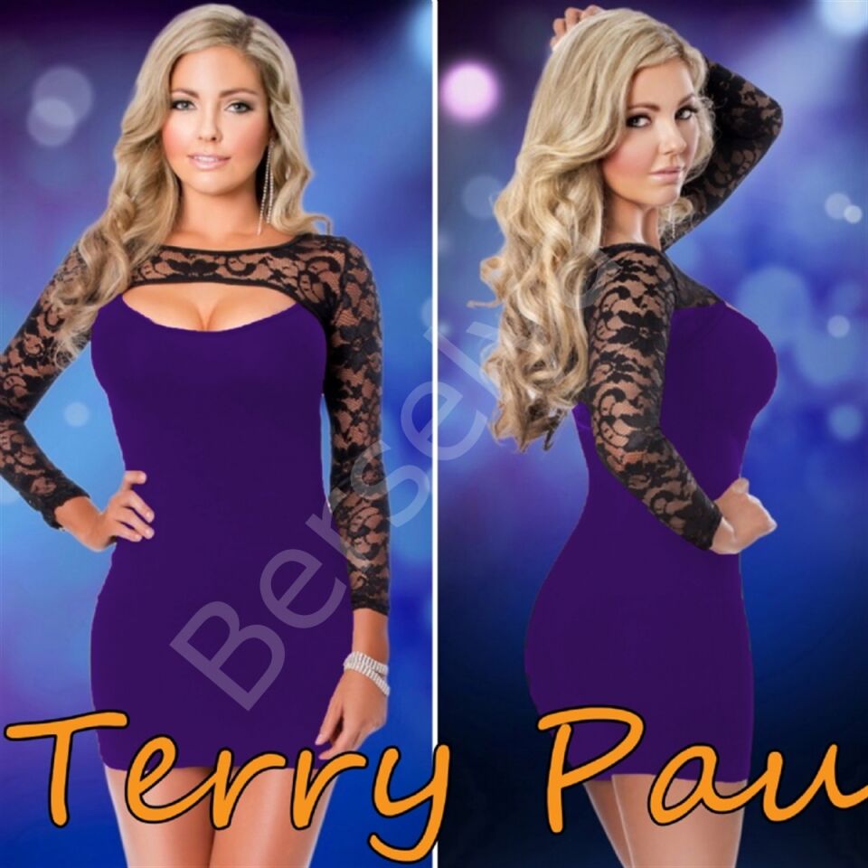 B101169 Dantel Detaylı Elbise